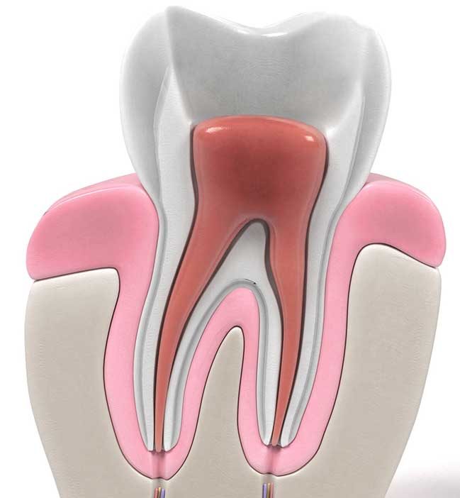 Root Canals Boise ID - Save Your Badly Infected Tooth