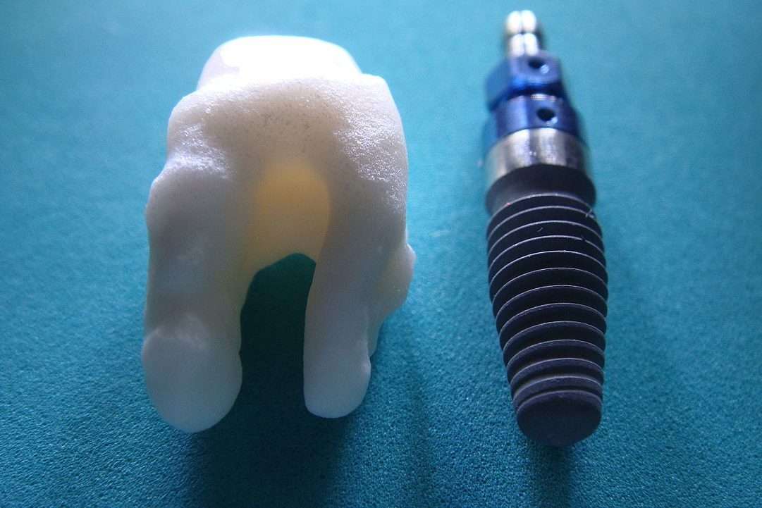 Tool of Dental Implanting