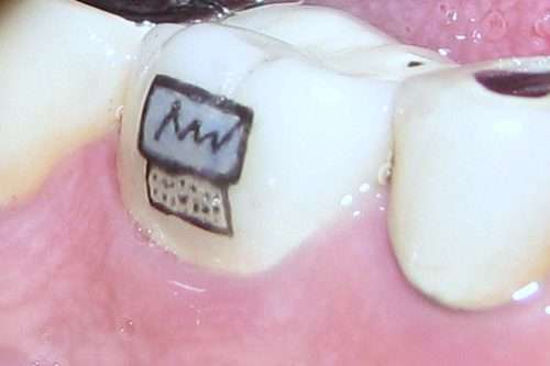 Drew Image on the Teeth