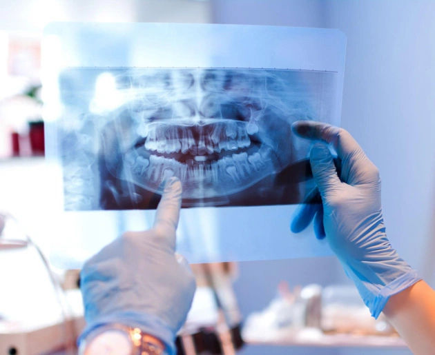 Dentist examining digital panoramic X-ray of patient's teeth in clinical setting.